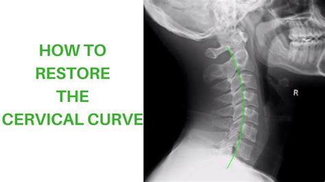 Normal Cervical Curve
