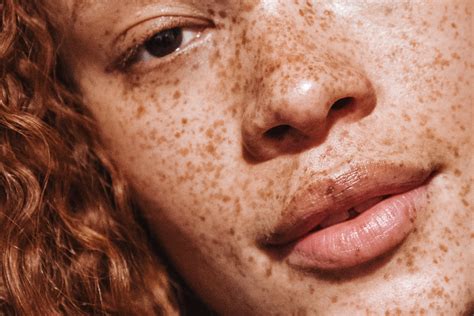 Everything You Wanted To Know About Freckles Into The Gloss