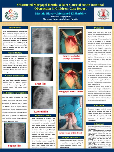 Pdf Obstructed Morgagni Hernia A Rare Cause Of Acute Intestinal