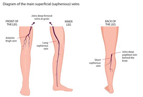 Normal Veins Vs Varicose Veins Differences Southwest Veins