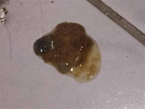 Wahl der richtigen milch stillen ist das beste für ihr baby, denn muttermilch versorgt das baby mit allen wichtigen nährstoffen. Schleim aus dem Popo von der Katze ? (Gesundheit ...