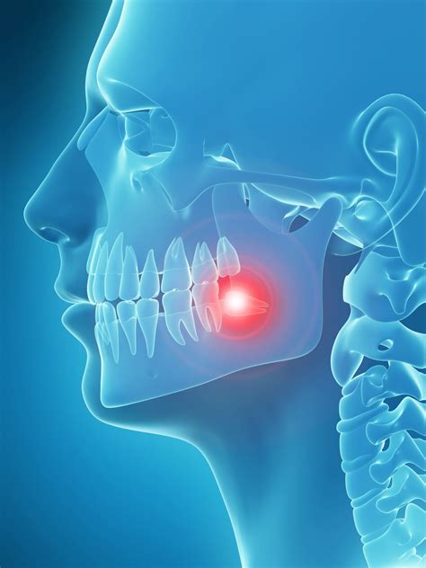 Keeping Your Tooth Extraction Comfortable Santa Rosa Oral Surgery