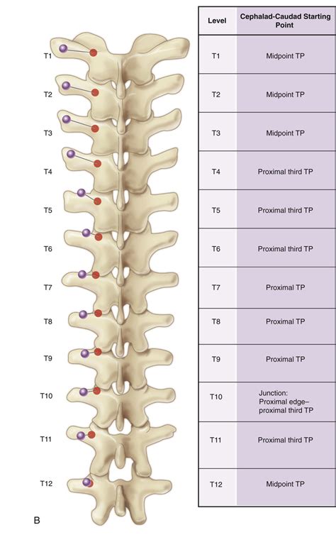 Posterior Spinal Instrumentation And Fusion Using Pedicle Screws Musculoskeletal Key