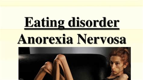 Anorexia Nervosa And Its Types Youtube
