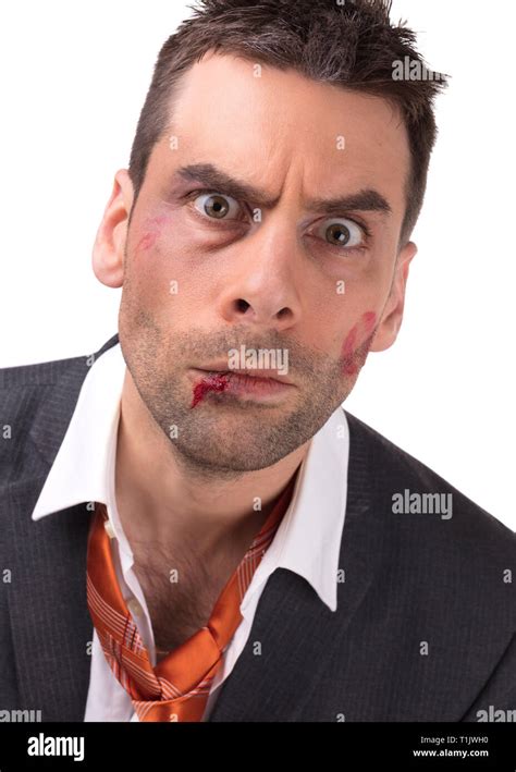 Close Up Of A Businessman With Bloody Lip Beaten And Bruised Isolated