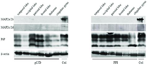 Analyses Of The Levels Of Map In The Brain Tissues Of Human Prion