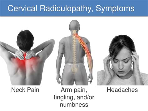 Cervical Spine And Arm Pain