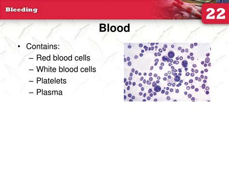 Ppt 22 Bleeding Powerpoint Presentation Free Download Id4562476