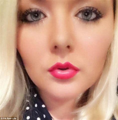 Nurse Who Began Using Sunbeds Aged 13 Reveals Hole Surgeons Cut Out Of
