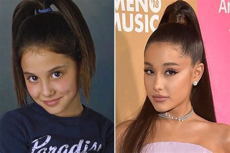 Ariana Grande Before And After The Power Of Plastic Surgery Demotix