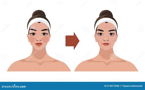 The Aging Process Of A Woman Age Related Changes In The Face