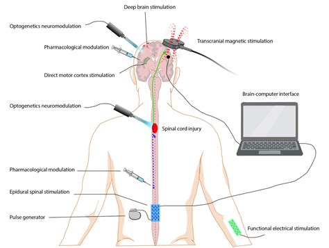 Figure From Restoring Sensorimotor Function Through Neuromodulation