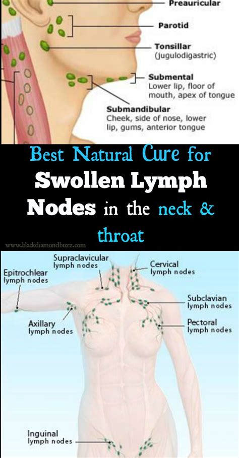 Swollen Lymph Nodes Neck Groin And Armpit
