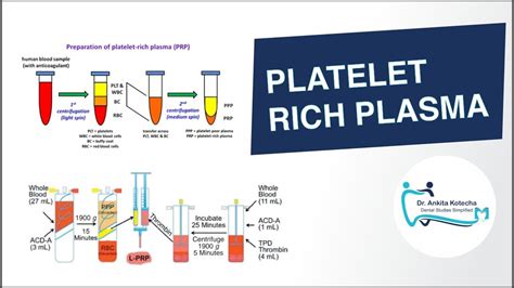PLATELET RICH PLASMA PRP IN PERIODONTICS BIOLOGIC PROPERTIES