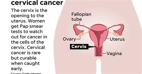 What Do U Do If U Have Cervical Cancer What Does Oral Cancer Look Like Images And Symptoms