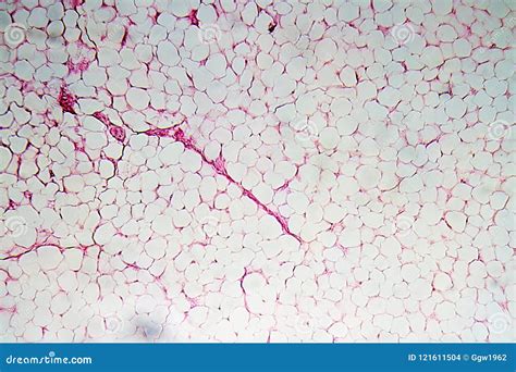 Adipose Tissue Under Microscope View Show Contains Large Lipid Droplet