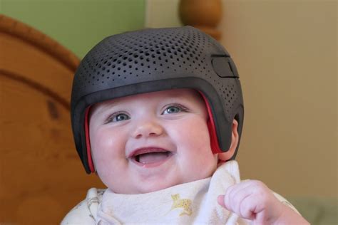 A Helmet What Do The Doctors Mean By Flat Head Syndrome Mothering Forum