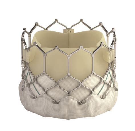 Fda Approves Tavr For Low Risk Patients Creates A Paradigm Shift In