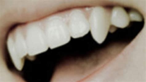 Vampire Teeth Fangs Veneers With Dental Putty Twilight Halloween Blade