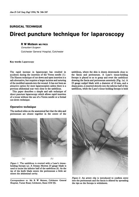 Pdf Direct Puncture Technique For Laparoscopy