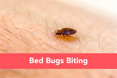 Bed Bugs Rash Treatment