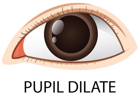 Understanding Mydriasis Or Dilated Pupils Eye Solutions