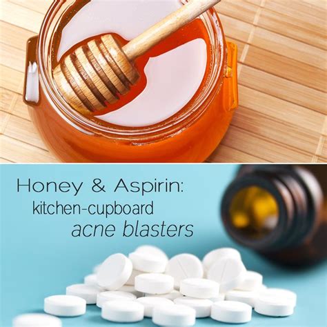 Two Home Remedies That Zap Away Acne Beauty Remedies Health And