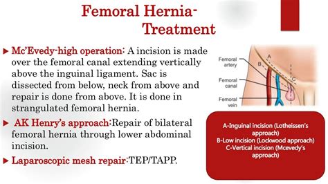 Femoral Hernia Groin Swellings