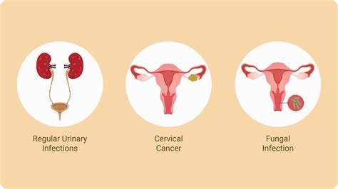 Created as a global advocacy platform, menstrual hygiene day seeks to highlight the impact that periods and period poverty can have on people that far extends beyond their may 28, 2020,06:30am edt|. Menstrual Hygiene Day. Over 23 million girls drop out of ...