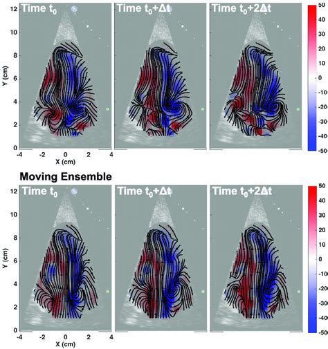 Early Diastolic Inflow Comparison For Pairwise And Moving Ensemble Me