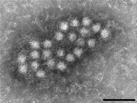 Medical Microbiology Understanding Anelloviruses