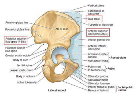 Iliac Crest Pain - Causes, Treatment and Prevention