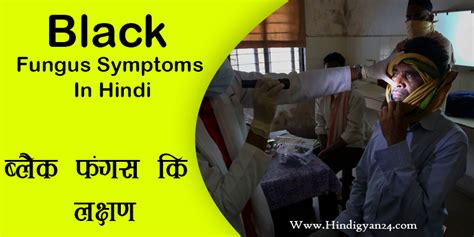 Black Fungus Symptoms In Hindi ब्लैक फंगस के लक्षण क्या है