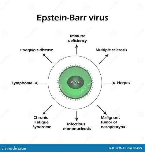 Epstein Barr Virus Diseases Caused By A Virus Infographics Stock