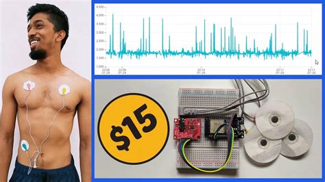 IoT Based Low Cost ECG Heart Monitoring System With ESP32 And Ubidots