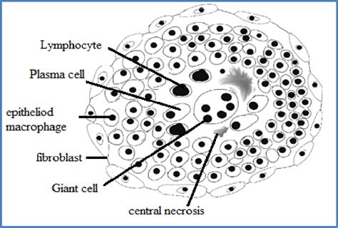 Components Of Granuloma Download Scientific Diagram