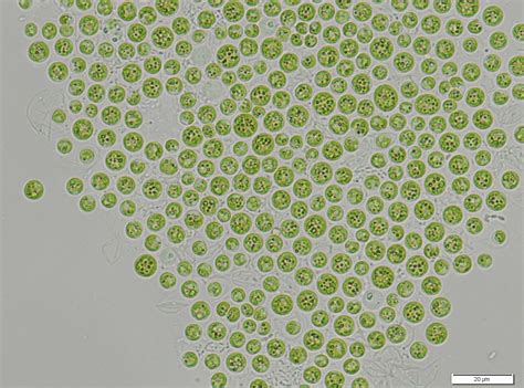 Cyanoro A Page Dedicated To Romanian Cyanobacteria Microcystis