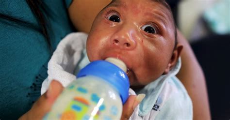 For pregnant women, however, infection with zika virus is linked to a severe birth defect called microcephaly, which results in an abnormally small head and brain. WHO Declares Zika Threat Over