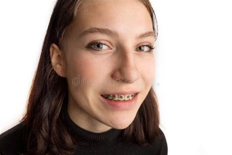 Orthodontic Treatment Dental Care Concept Smiling Teenage Girl With
