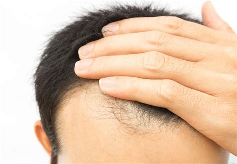 Zolpidem or ambien is the most commonly prescribed sleep aid. Biotin for hair growth: Dosage and side effects | Hair ...