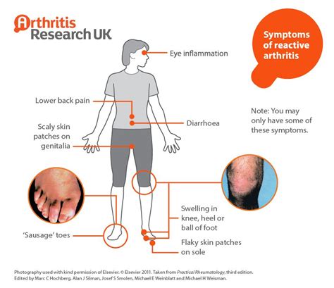 Pin On Arthritis Information