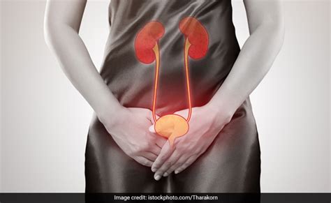Urinary Infections Uti Natural Treatments That Will Surely Work