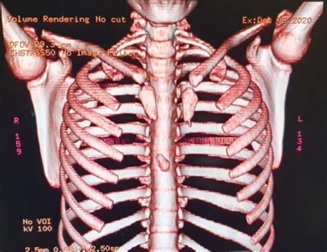We hope you enjoy our growing collection of hd images to use as a background or home screen for your. Stomach Ribs Lungs Picture / Lung Function What Do The ...
