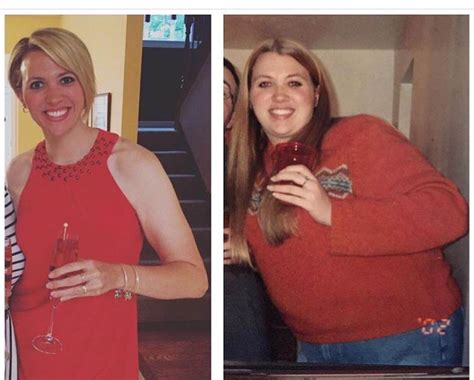 Pcos Weight Loss Before And After Blog Dandk