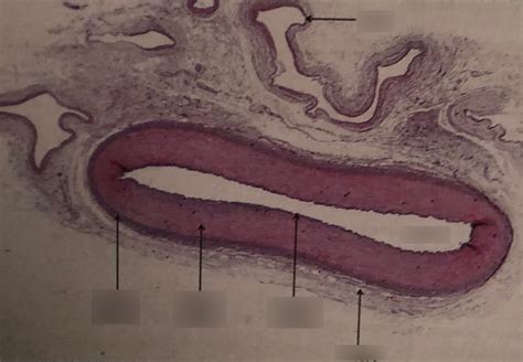 Artery Microscope Slide Micropedia