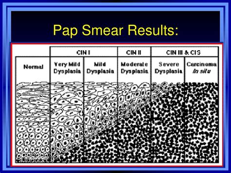 During a pap smear, your healthcare provider takes cells from the cervix to examine under a microscope for signs of cancer. PPT - Infection par le Papillomavirus Humain ( HPV ...