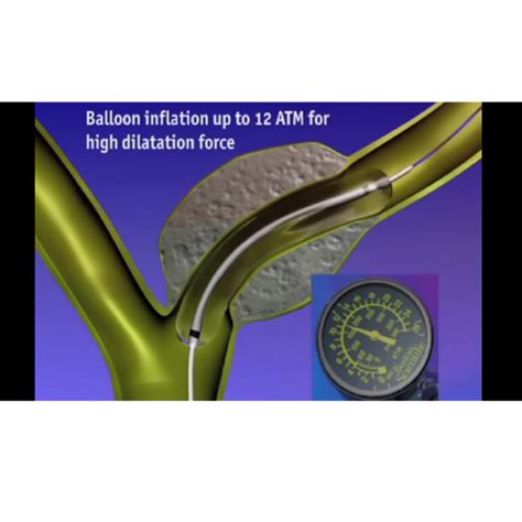 hurricane rx biliary balloon dilation catheter boston scientific