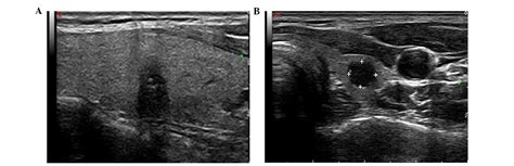 Contrast Enhanced Ultrasound And Real Time Elastography In The