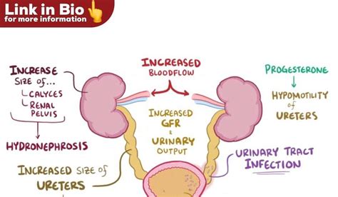 How Long Does Kidney Pain Last With Infection