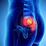 Lower Back Pain  ESP Physio Scotland